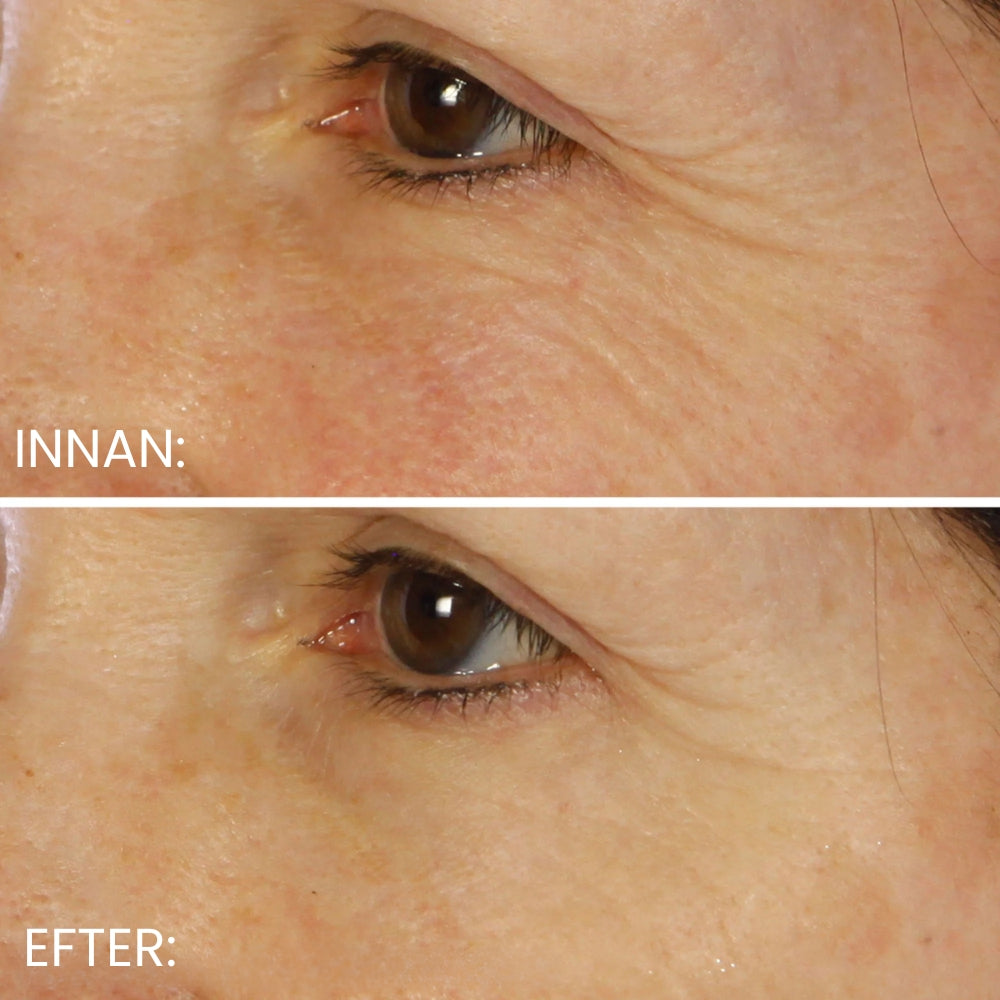 Eye pads – Against lines & tired look 24 pcs