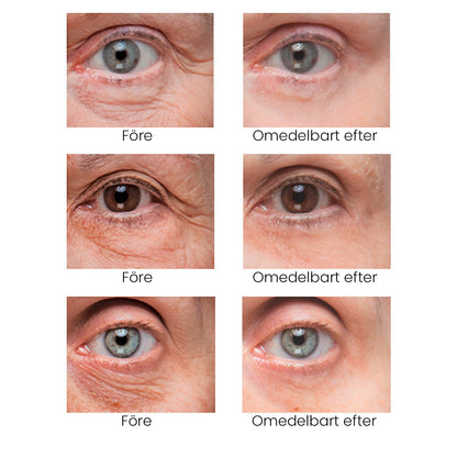 BrightUp - Instant Eye Tightener