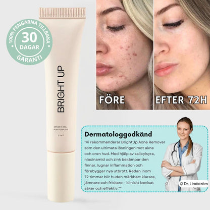 BrightUp Acne Remover