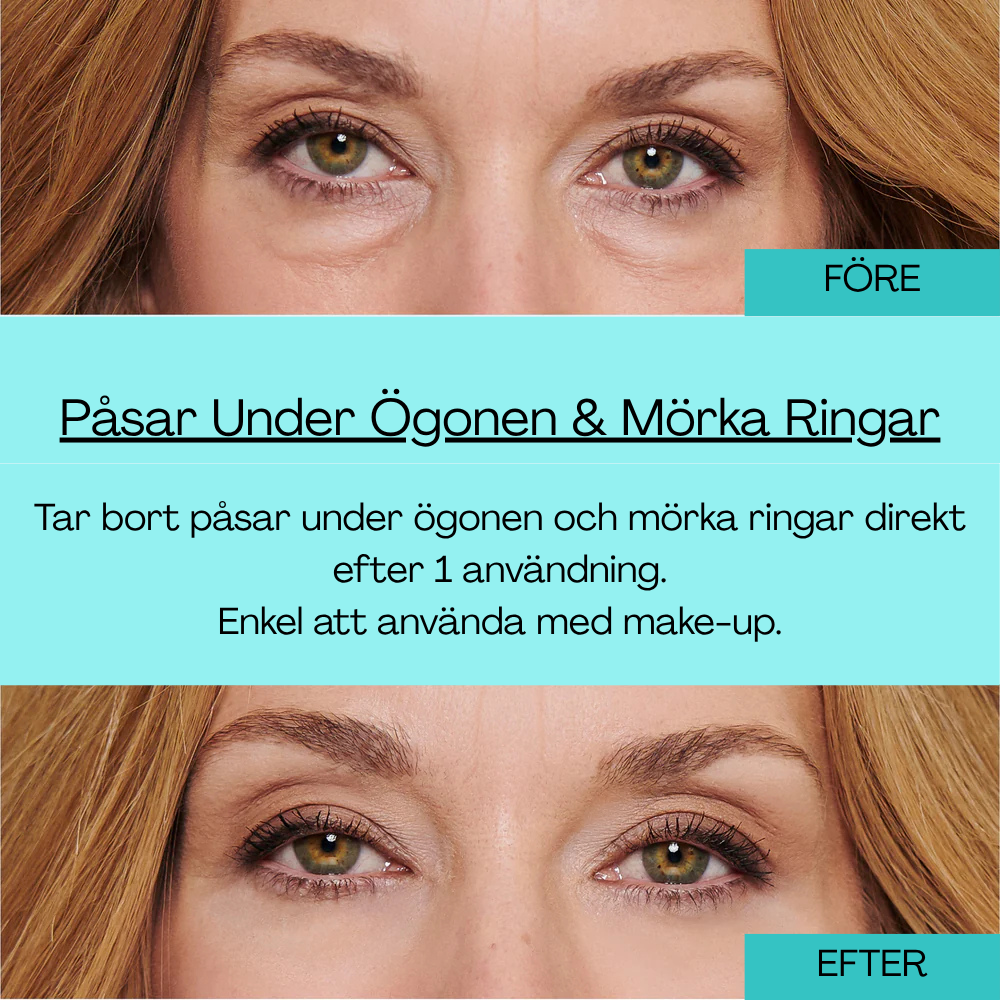 BrightUp - Instant Eye Tightener