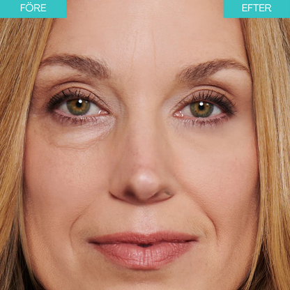 BrightUp - Instant Eye Tightener